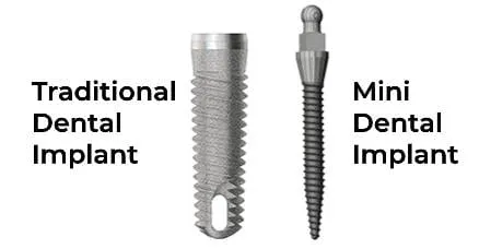 Different types of screws

Description automatically generated
