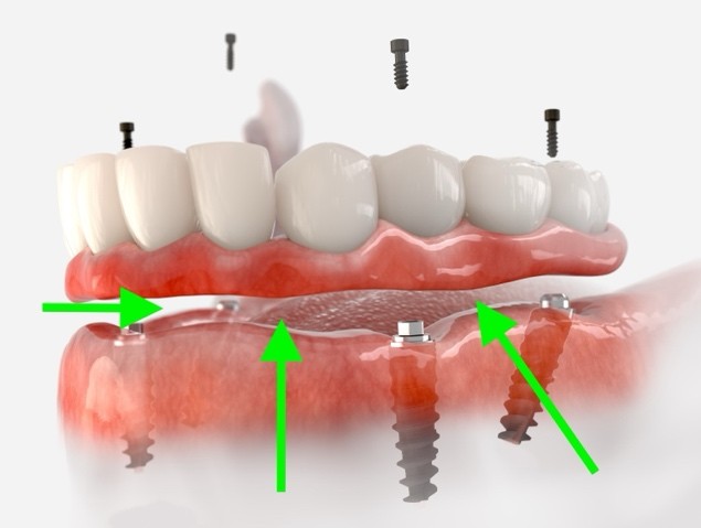 A close-up of a human teeth

Description automatically generated