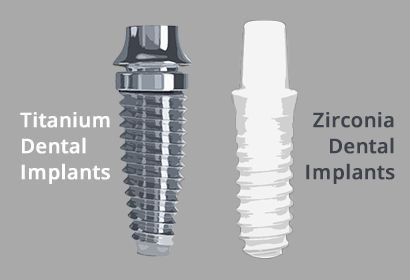 Several different types of dental implants

Description automatically generated