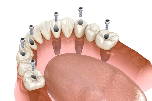 A close-up of a human teeth

Description automatically generated