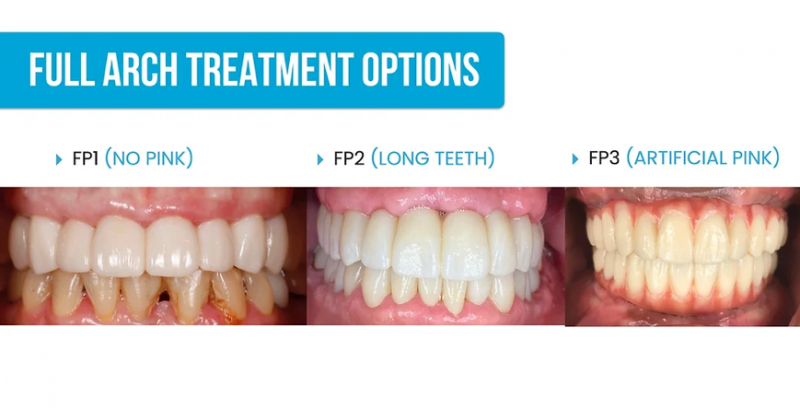 A collage of teeth and gums

Description automatically generated