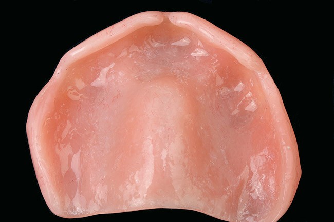A close-up of a human mouth

Description automatically generated