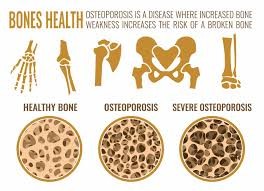 A diagram of bones and bones

Description automatically generated