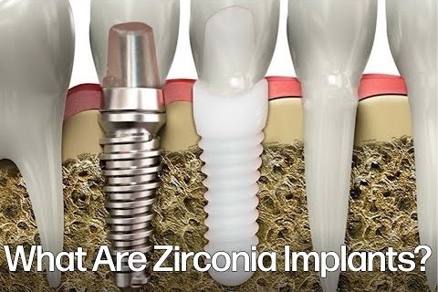 A close-up of a dental implant

Description automatically generated