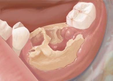 A close-up of a human mouth

Description automatically generated