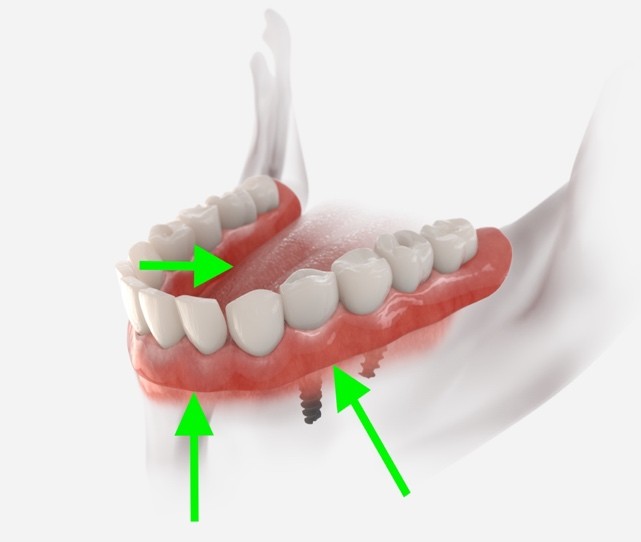 A close-up of a human teeth

Description automatically generated
