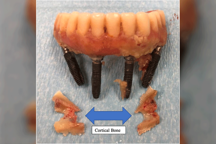 A close-up of a model of teeth

Description automatically generated