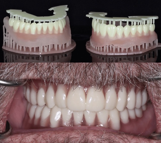 A close-up of a person's teeth

Description automatically generated