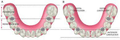 A comparison of teeth with different types of teeth

AI-generated content may be incorrect.