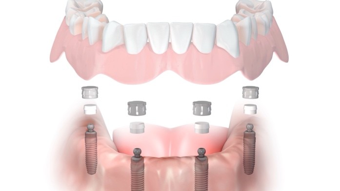 A close-up of a human teeth

Description automatically generated