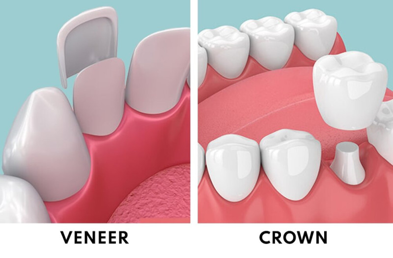 A comparison of teeth and gums

AI-generated content may be incorrect.