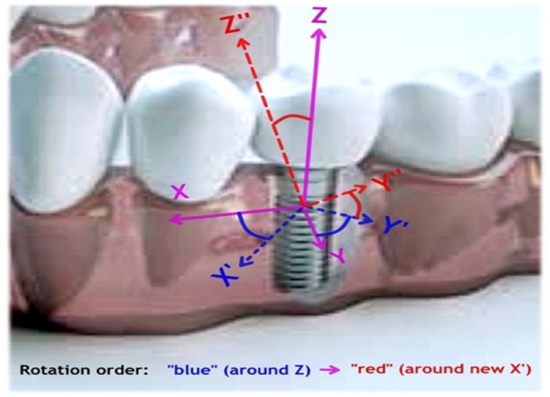 A close-up of a model of teeth

Description automatically generated