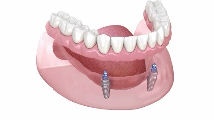 A model of a human jaw

Description automatically generated