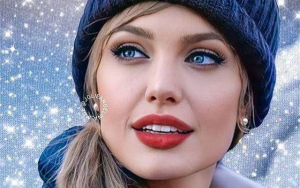 玻尿酸丰唇----奥斯丁NeoSoma专业医美让您的颜值瞬间上升一个档次！