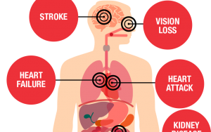 周启诚牙医专栏 51 — 高血压和你应该知道的事!