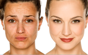 美容大王大S推荐的美白针，4个秘方！奥斯丁NeoSoma专业医美让您快速变白月光女神！