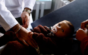 聯合國:至少1400萬兒童面臨飢餓或死亡風險